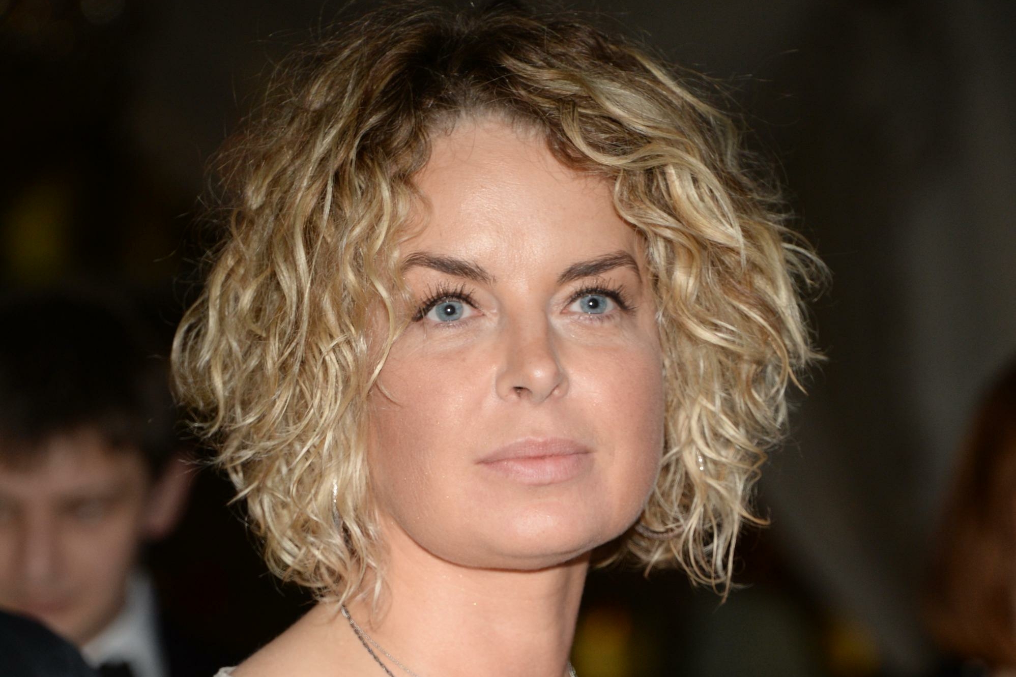 Перекосило: российская артистка показала последствия паралича лицевого нерва, как у Бибера